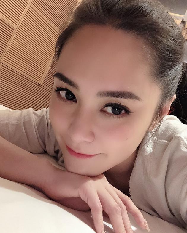 阿娇晒露额头自拍美照 五官精致自称妆好靓